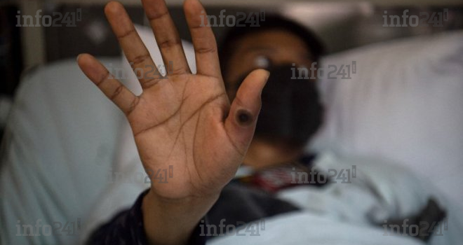 Variole du singe en Afrique&nbsp;: Plus de 31 000 cas recensés et 844 décès depuis janvier